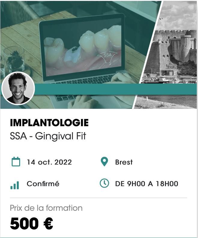 SSA Gingival Fit - Biotech Dental - Brest