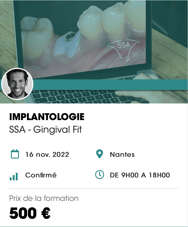 SSA Gingival Fit - Biotech Dental - Nantes